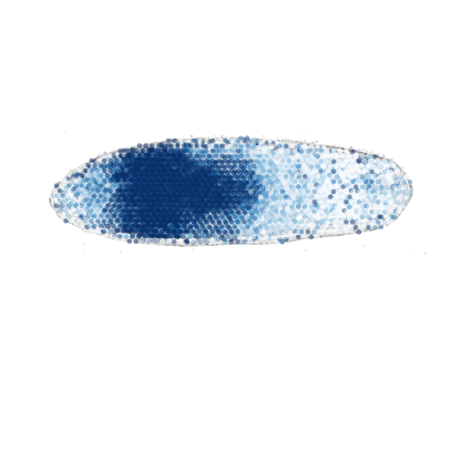 _images/Case_II_STAVAG_on_3D_planarian_data_13_11.png