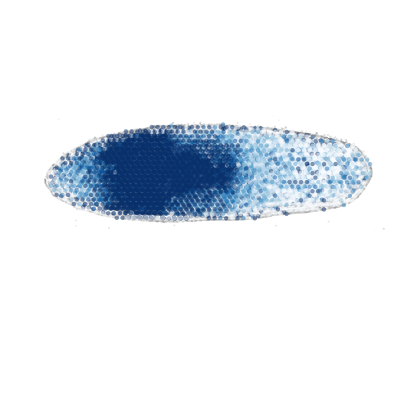 _images/Case_II_STAVAG_on_3D_planarian_data_13_5.png